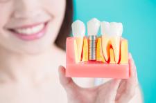 Dentica Bieleccy – pionierem implantologii w Raciborzu Dentica Bieleccy – pionierem implantologii w Raciborzu