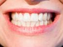 Nić dentystyczna – najważniejsze informacje Nić dentystyczna – najważniejsze informacje