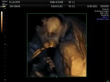 USG 4 D świetnym początkiem rodzinnego albumu