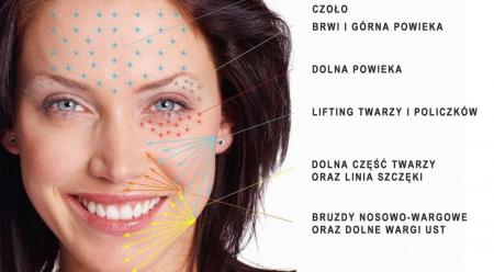 osocze bogatopłytkowe