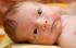 trądzik noworodkowy