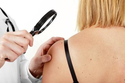 wizyta u dermatologa